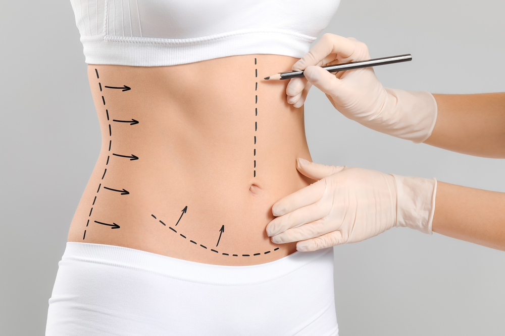 Body Contouring in Cypress, TX